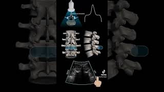 Lumbar Neuraxial Sonography [upl. by Annal288]