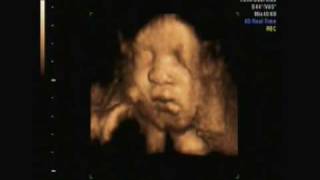 7 month 4D ultrasound [upl. by Enelime]