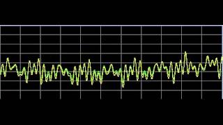 Nervous System Disorders  Rife Frequencies [upl. by Nylodnew]