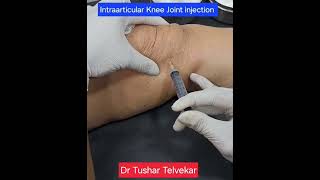 kneeinjection kneepain Intraarticularkneeinjection drtushartelvekar osteoarthritis [upl. by Lehman]