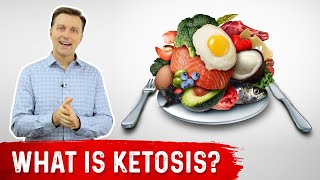 What is Ketosis  Dr Berg [upl. by Gensler]