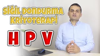 Siğil Dondurma Kriyoterapi  Doç Dr Erkan Erdem [upl. by Yluj860]