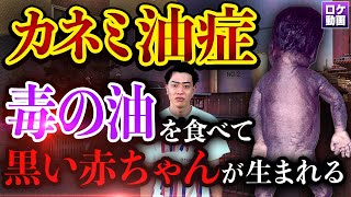 【カネミ油症事件】黒い赤ちゃんが産まれる…戦後最大の食品公害を現地からわかりやすく解説 [upl. by Amelie]