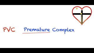 Premature Ventricular Contractions PVC Interpretation Easy and Simple [upl. by Ainoz965]