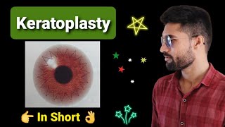 Keratoplasty lecture in opthalmology [upl. by Bazar394]