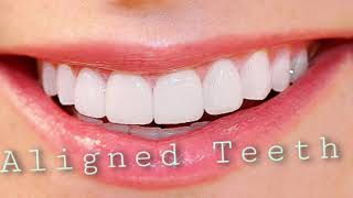 Align and straighten teeth POWERFUL⚠️ [upl. by Yema]