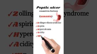 peptic ulcer causative factors [upl. by Edwyna]