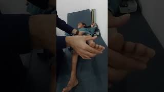 How to check clasp knife Spasticity clonus reflexes [upl. by Nilyam427]