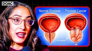 Is THIS One Habit Secretly Reducing Risk Of PROSTATE CANCER  Dr Rena Malik Explains [upl. by Nade]