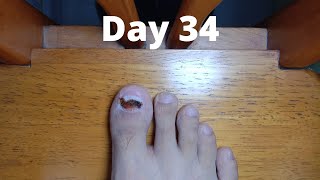 Toenail Timelapse [upl. by Dallas858]