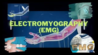 Electromyography  Electromyograph  Electromyogram  EMG  EMG Test  EMG Procedure [upl. by Ramedlav]