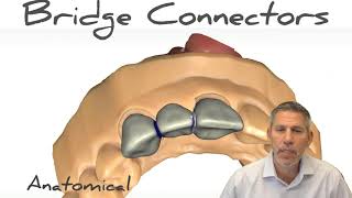 Tip of the Day Bridge connector [upl. by Burnham218]