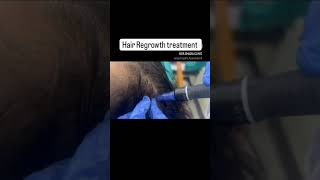 Hair Regrowth treatment haircare drshazia hairgrowth hairgrowthtips [upl. by Petite807]