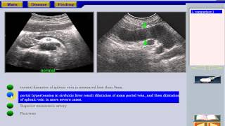 Ultrasound of the Liver 4 in Arabic [upl. by Llebiram216]