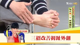 腰痛查不出原因，竟是「拇指外翻」造成的！三招改善讓腳不變形 健康20 [upl. by Fujio]