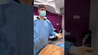 Dr Levy  Explains 4K HighDefinition Abdominal Liposuction made with VASER PRO [upl. by Hahnert]