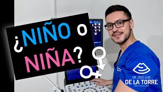 ¿Cómo saber si es NIÑO o NIÑA por ULTRASONIDO [upl. by Dira709]