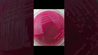 Growth of E Coli bacteria on various type of culture medi [upl. by Ullund812]