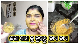 How to remove black spots from face at home  Best Home Remedies for remove dark spot [upl. by Lacee]