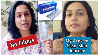 Best Acne Disprin Mask  My Severe Acne to Clear Skin Journey क्या और कैसे ठीक किया बिना दवाई खाऐ [upl. by Anwahsat]