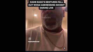 Dame Dash dentures fell out on live [upl. by Kcirdde]