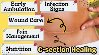 Post CSECTION HEALING  PAIN SCAR MASSAGE  WOUND CARE  INFECTION SIGNS [upl. by Iver]