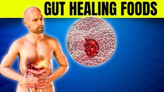 6 Best Prebiotic Foods for Ultimate Gut Health Balance [upl. by Killion18]