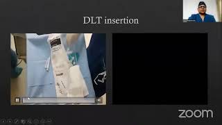 APPEC2023 DAY 2 Equipment DLT and Bronchial Blockers [upl. by Idnyc]