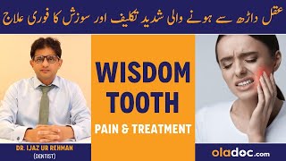 Wisdom Teeth Pain amp Treatment  Aqal Darh Ke Dard Ka Ilaj  Wisdom Teeth Removal  Pain Home Remedy [upl. by Gerfen]