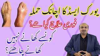 Acute Gout Attack  How To Manage Acute Gout  What Foods To Avoid In Chronic Gout  dr afzal [upl. by Atarman]