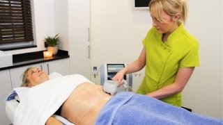 NonSurgical Liposuction and Body Contouring  Exilis Elite  Award Winning Treatment [upl. by Cinomod]