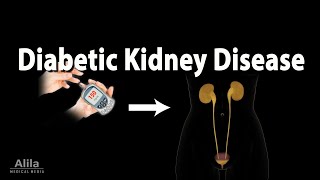 Diabetic Kidney Disease Animation [upl. by Earl375]