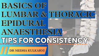 Mastering Epidural Anesthesia Essential Tips for Consistency I Dr Medha Kulkarni [upl. by Mozza426]