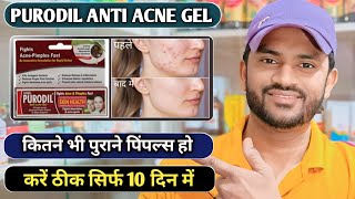 Purodil anti acne gel use benefits and side effects full review in hindi [upl. by Dusa]