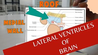 Boundaries of Lateral Ventricle of Brain  Anatomy of Lateral ventricles [upl. by Nylzor854]