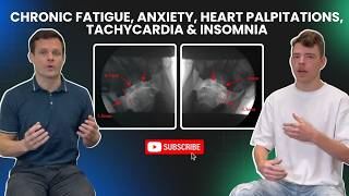 Chronic fatigue Anxiety Heart palpitations Tachycardia Insomnia  Upper Cervical Instability [upl. by Mackie871]