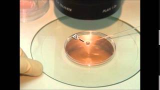 vitrification of embryos and oocytes [upl. by Inah316]