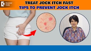 Jock Itch Tinea Cruris Best ways to avoid Itching Down There  Dr Rasya Dixit Doctors Circle [upl. by Borlow]