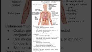 Signs and symptoms of anaphylaxis [upl. by Engelhart]