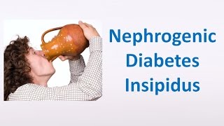 Nephrogenic Diabetes Insipidus [upl. by Noid]