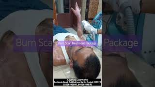 Burn Scar Treatment Package burnscartreatment kayakalplaserclinic [upl. by Naitsirhk]