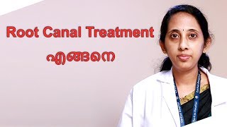 Root Canal Treatment എങ്ങനെ  LATEST MALAYALAM HEALTH TIPS [upl. by Adnaugal301]