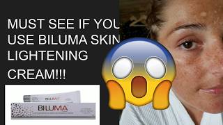 DO NOT use BILUMA without watching this video [upl. by Lladnik340]