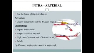 Intra Arterial Route of Drug Administration Injection [upl. by Igiul344]