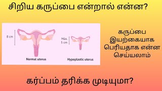 Small Uterus in Tamil  Hypoplastic Uterus  சிறிய கருப்பை என்றால் என்ன [upl. by Foss]