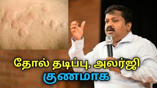 தோல் அலர்ஜி தடிப்பு குணமாக இயற்கை மருத்துவம்  DrSivaraman speech on remedy for skin allergy [upl. by Oak470]