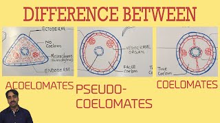 Acoelomates Pseudocoelomates and coelomates  Triploblastic organisation [upl. by Ansley]