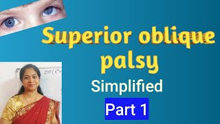 Superior Oblique palsy Trochlear nerve palsy Parks Bielschowsky testCauses Clinical features [upl. by Akimaj69]