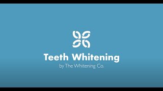 Teeth Whitening Treatment [upl. by Davidoff136]