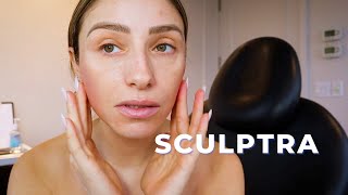 SCULPTRA TREATMENT  What is it What does it do Does it actually work [upl. by Oremoh506]